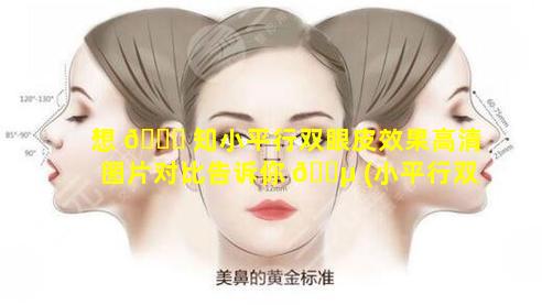 想 🕊 知小平行双眼皮效果高清图片对比告诉你 🌵 (小平行双眼皮和平行双眼皮区别)